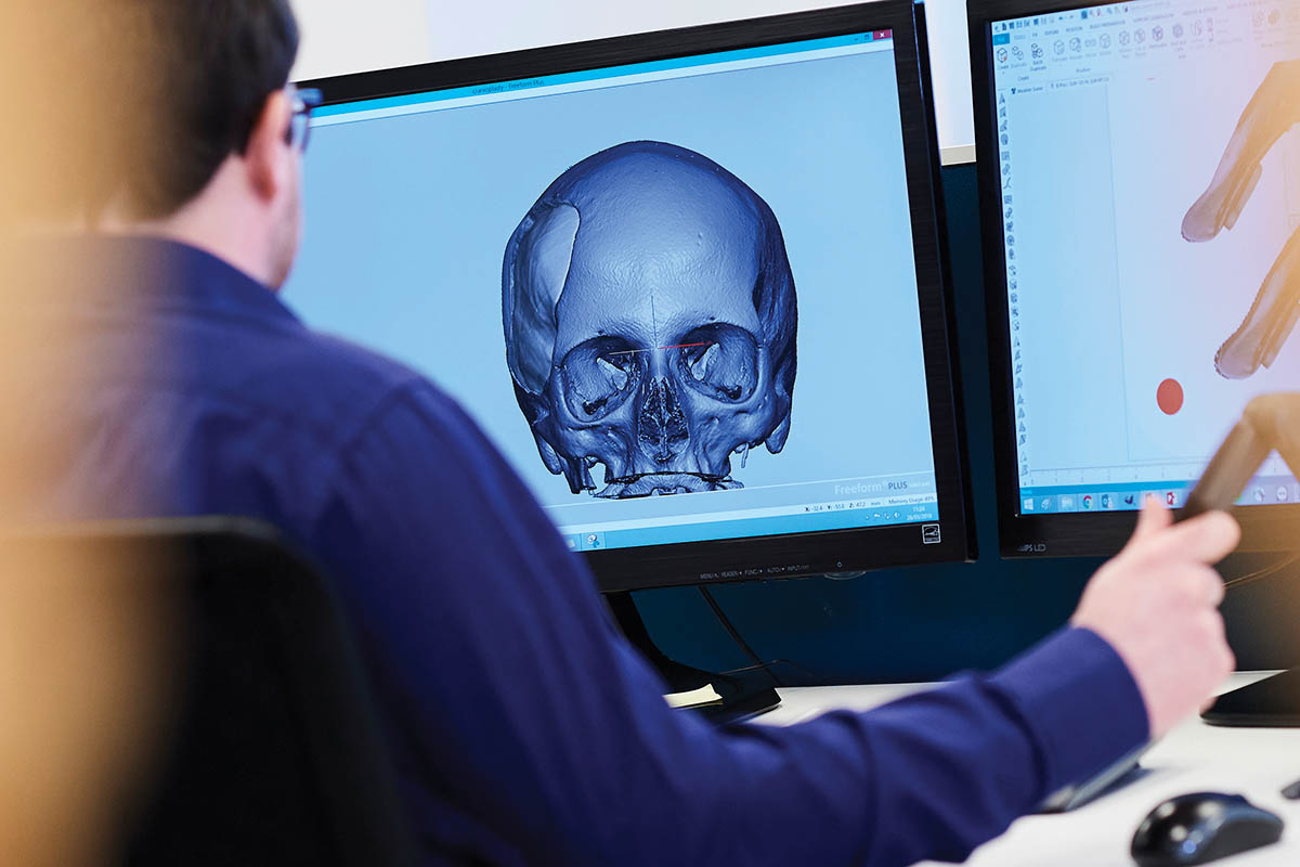 CADskills: Het nieuwe tijdperk van medische implantaten