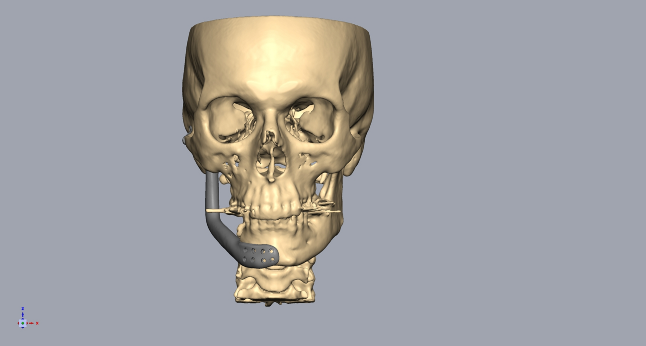 2 vacancies for biomedical designers/engineers