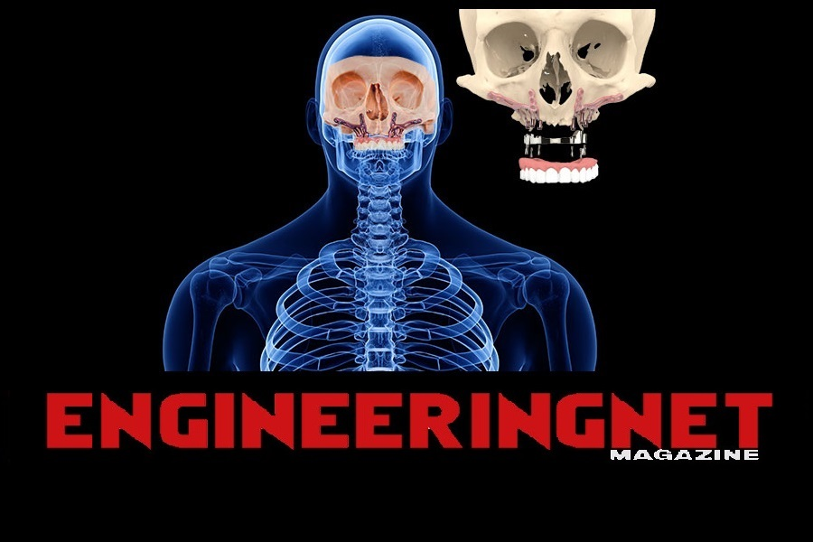 Article Engineeringnet - Surgical customization for prosthetic skulls