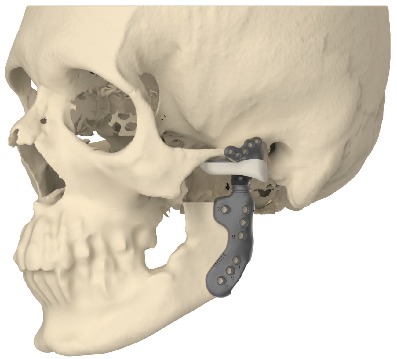 Skeleton tmj The Importance